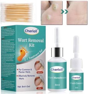 Cherioll-Wart-Removal-Kit