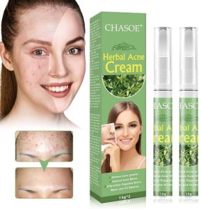 SEGMINISMART-Herbal-Acne-Cream